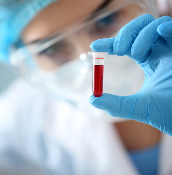 inserm-transfert-projet-recherche-03